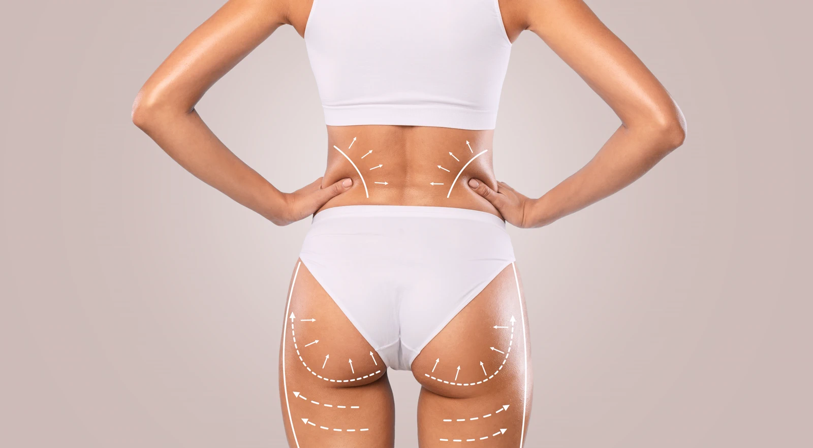 Brazilian Butt Lift (BBL)