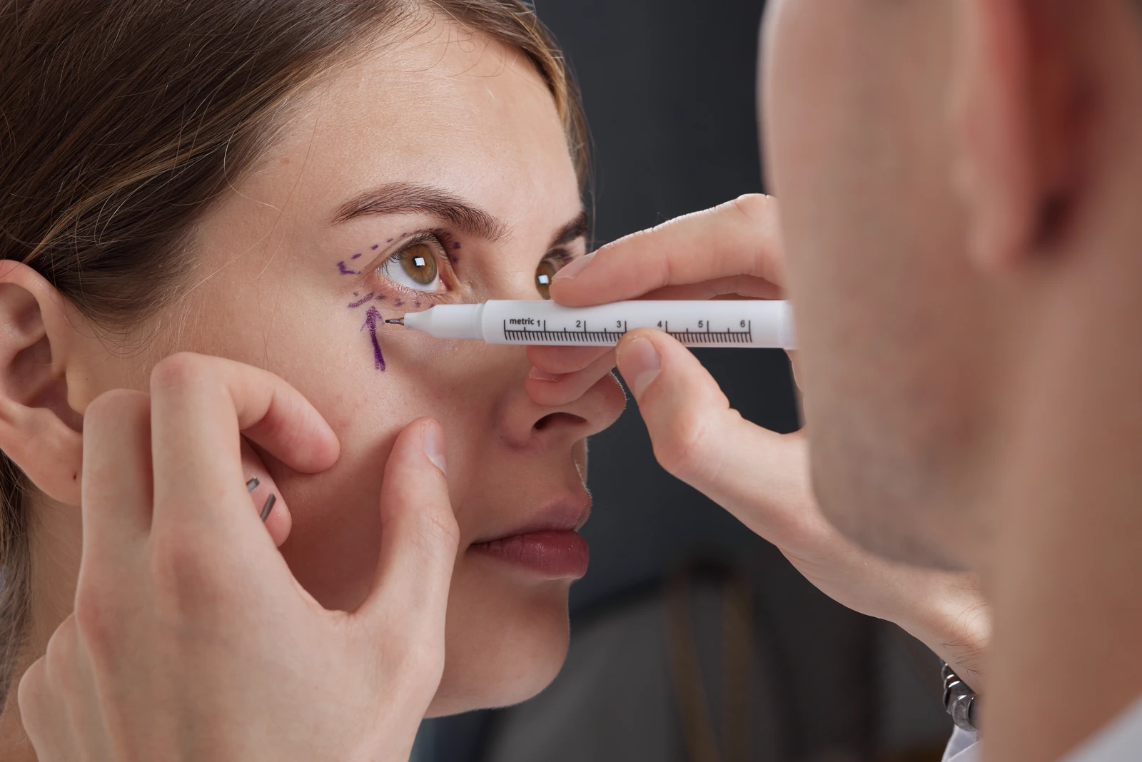 Eyelid Surgery
