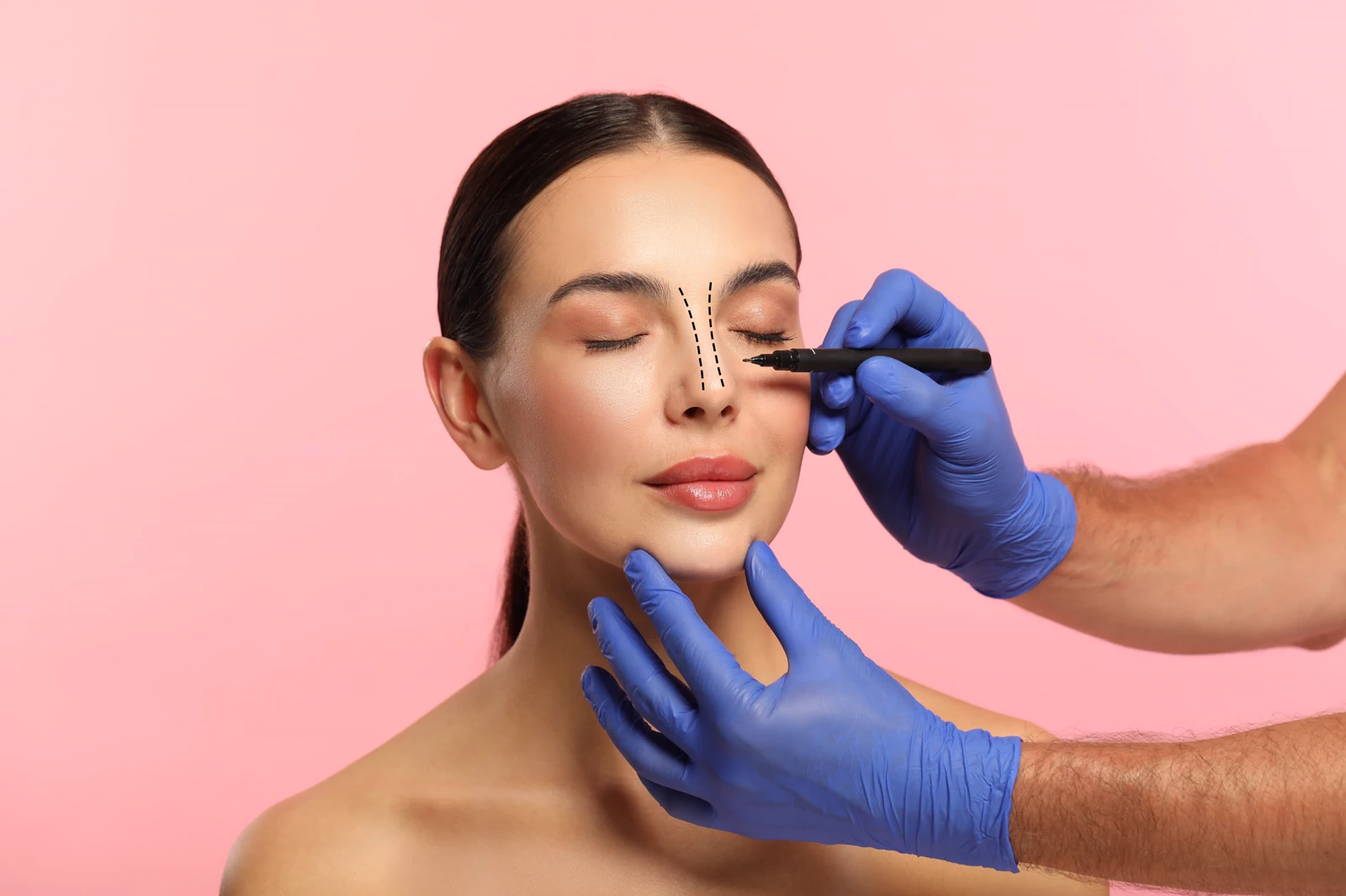 Rhinoplasty