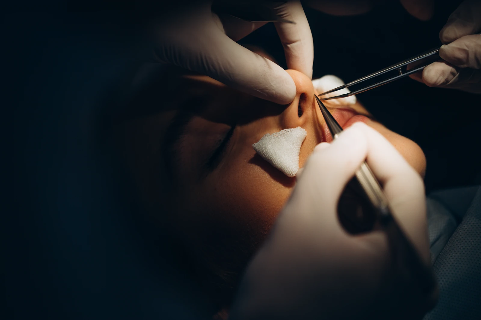 Septorhinoplasty