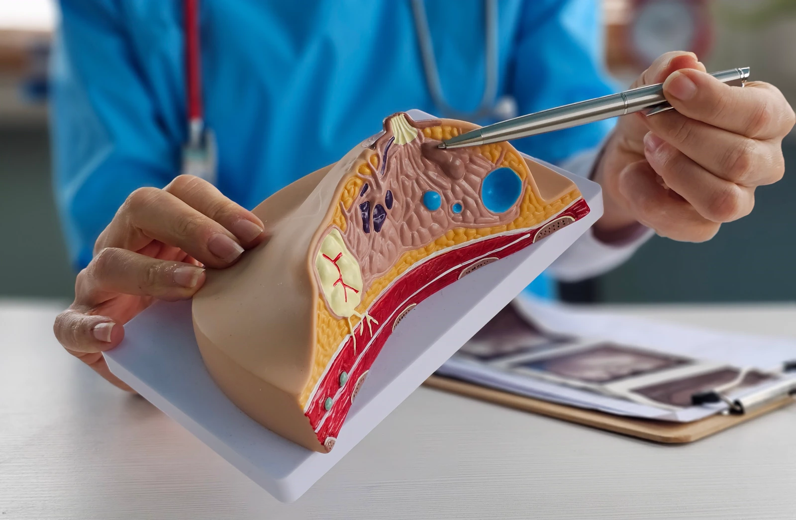 Breast Disease Evaluation