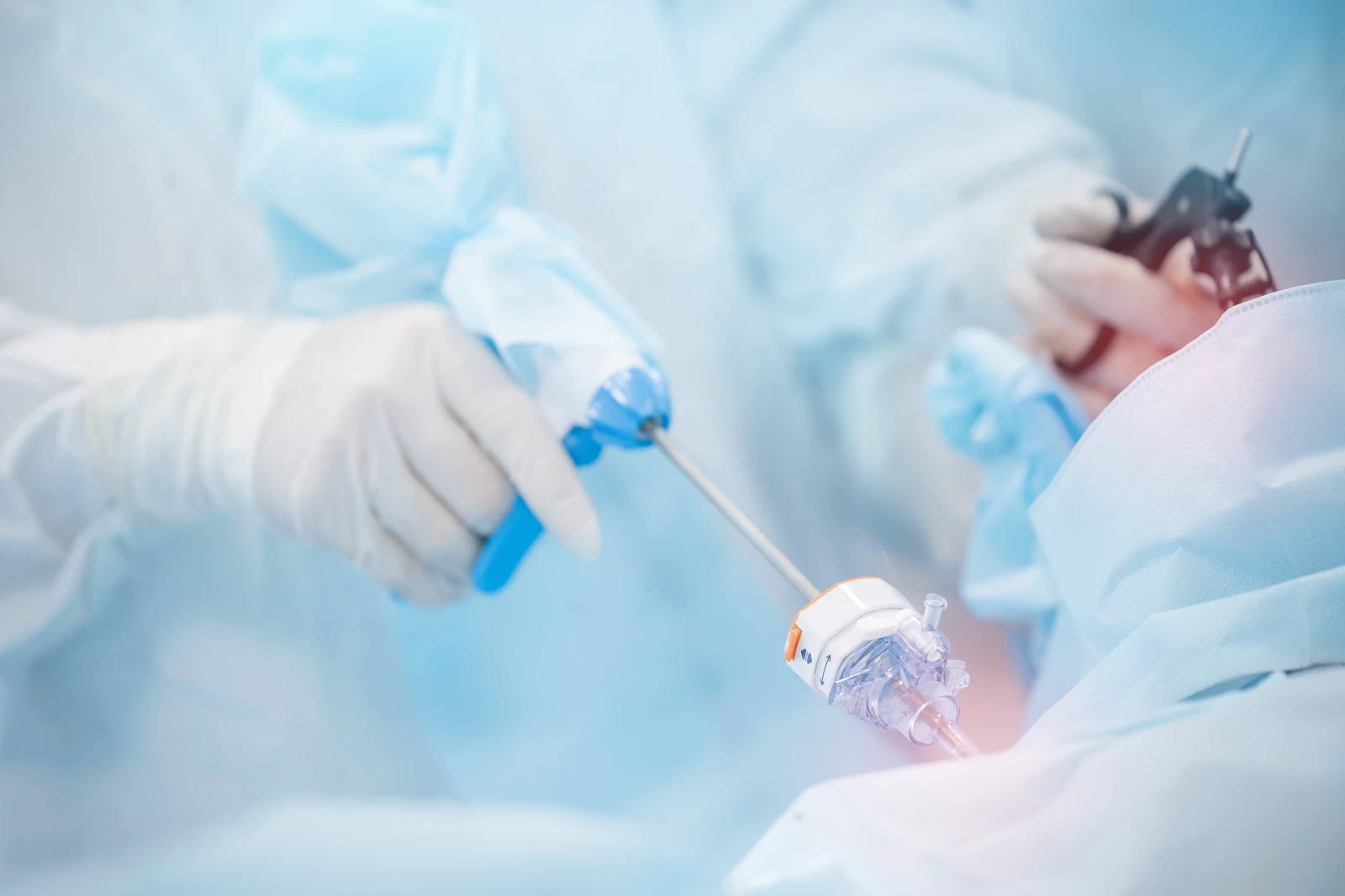 Laparoscopic Gynaecological Procedures