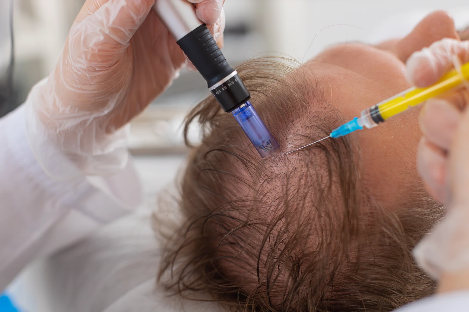 Stem Cell Therapy