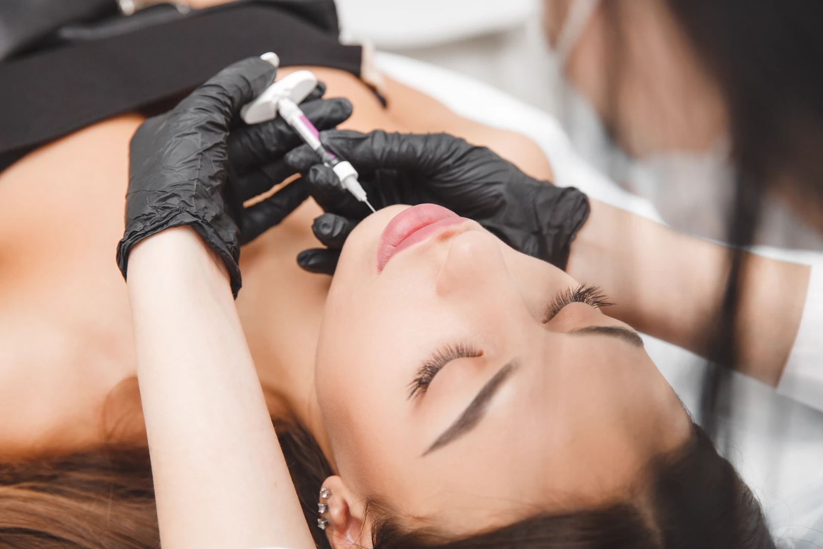 Cheek Filler