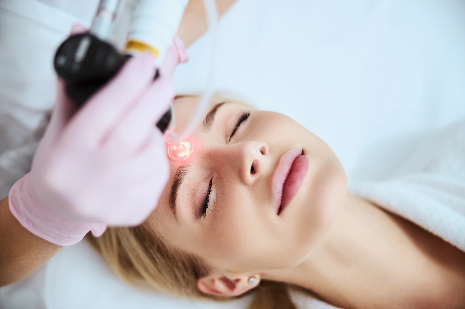 Fractional Laser