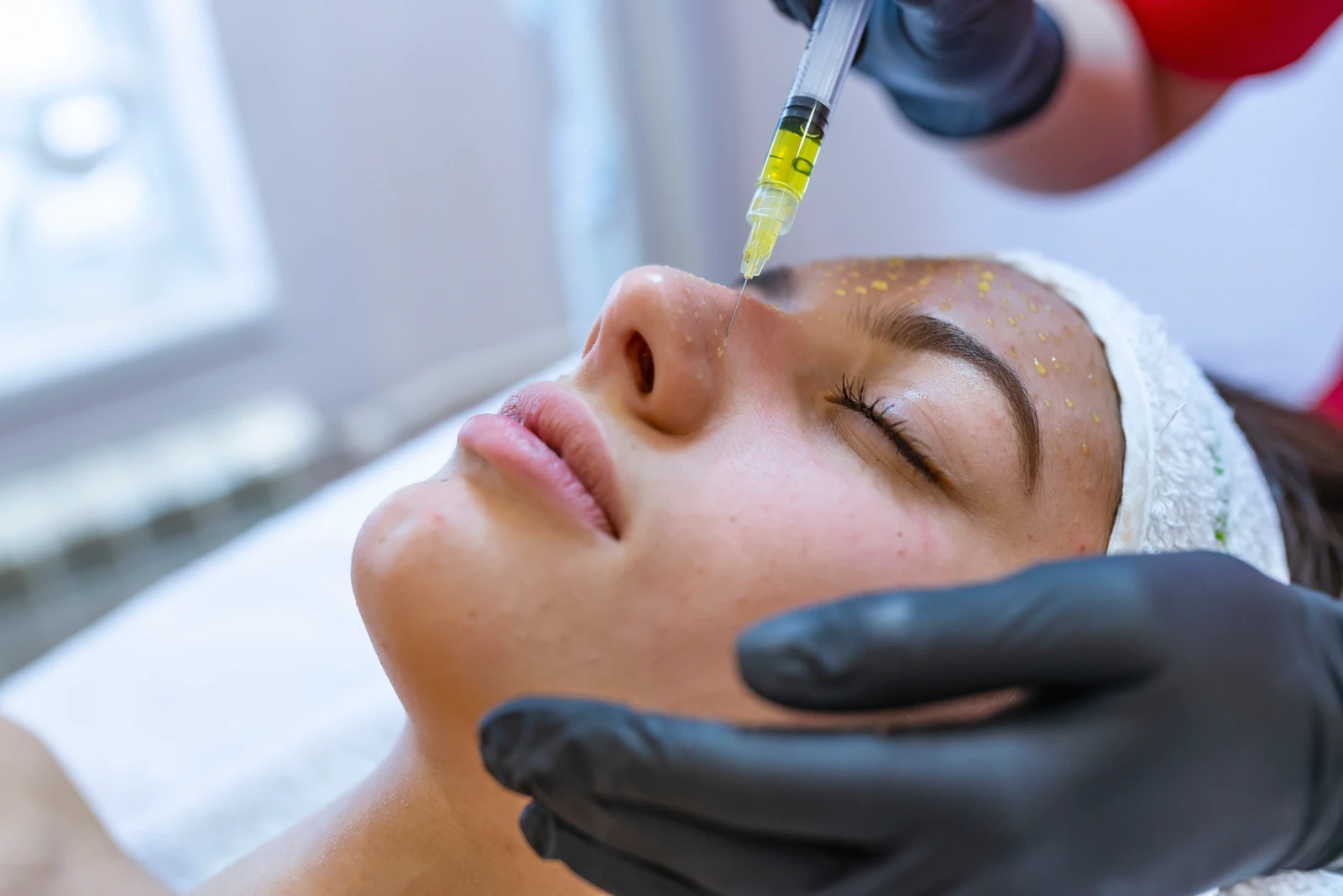 Mesotherapy