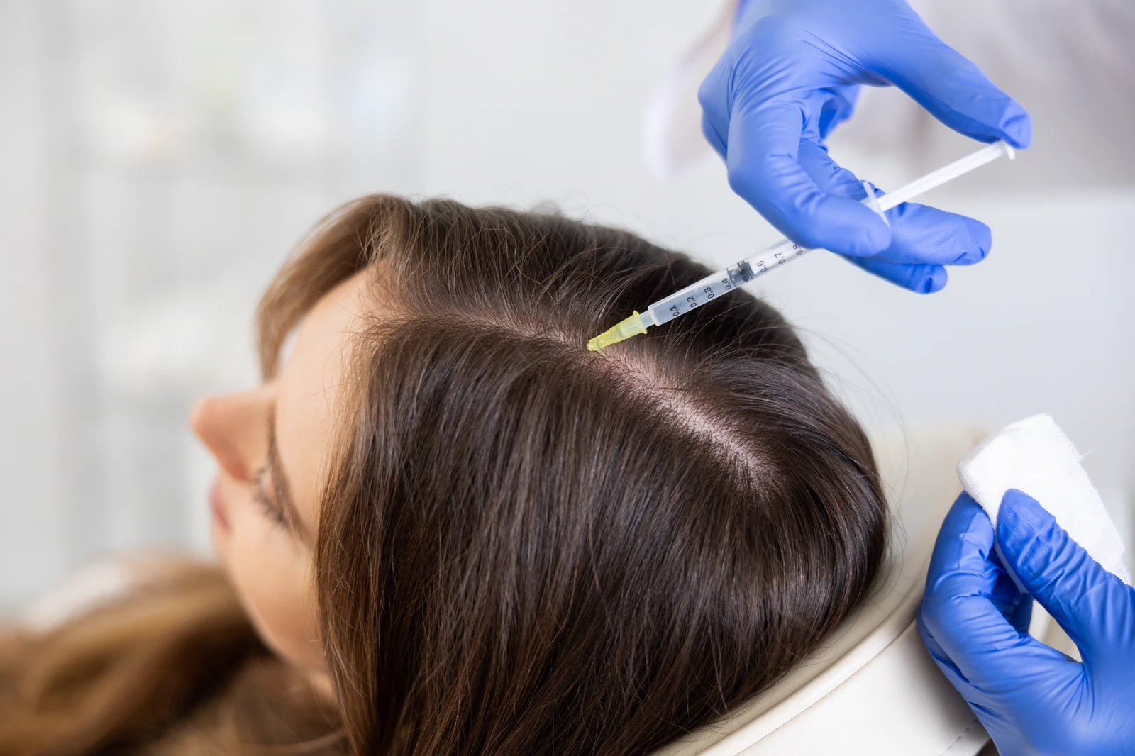PRP Treatment