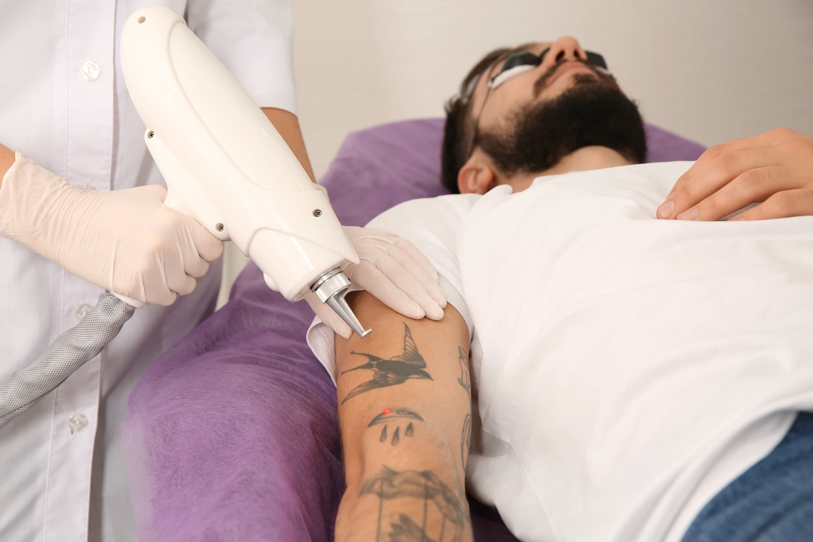Laser Tattoo Removal
