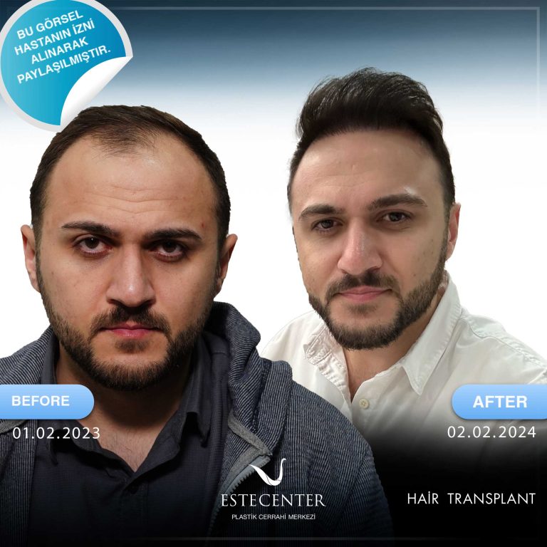 01.02.2023-ERCAN-AKAYDIN.jpg