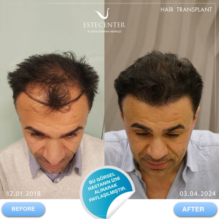 12.01.2018-TURGUT-DUMAN.jpg